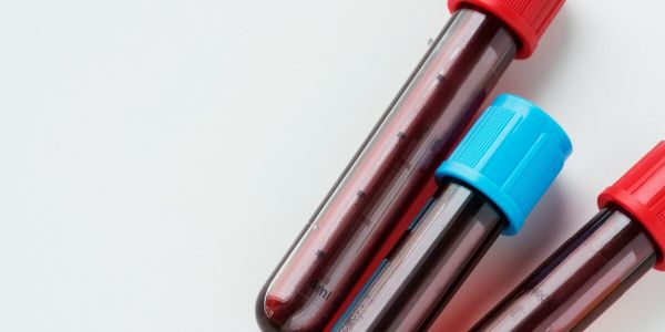 Homepage 30 Closeup of three blood test vials with red and blue caps.